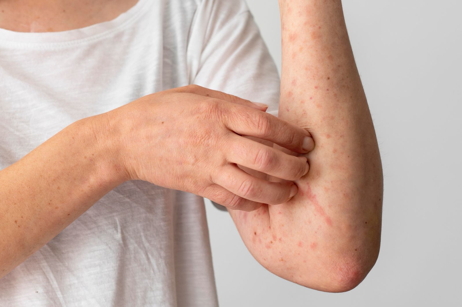 itchy skin